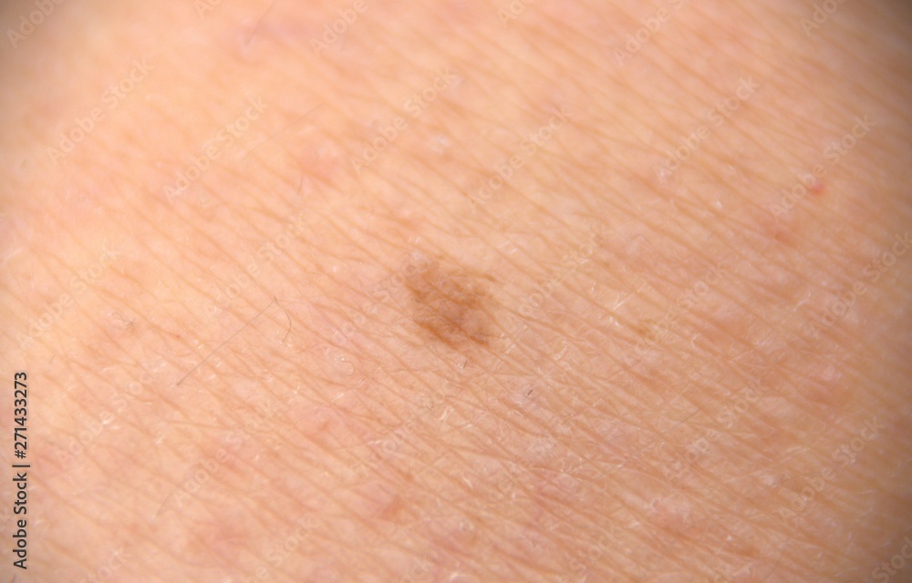 Fototapeta premium grain de beuté en gros plan sur la peau