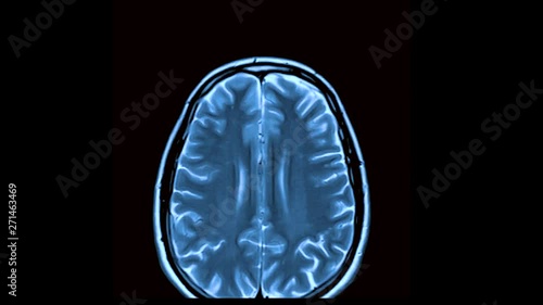 MRI timelapse brain scan,magnetic resonance imaging of a brain, ultra hd 4k, time lapse