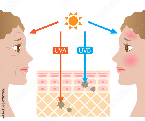 紫外線　肌の構造　外国人女性