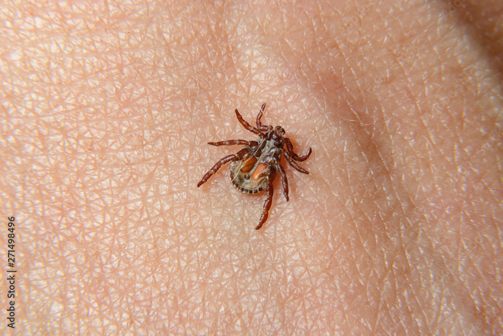 Forest mite on the skin. wood tick Forest mite on the skin. wood tick