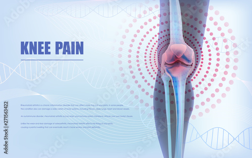 Knee pain relief, bones the of knee