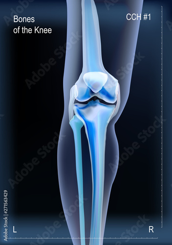 X ray of bones the of knee