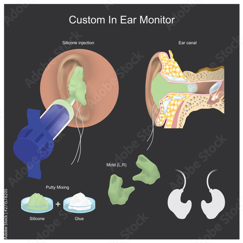 Custom In Ear Monitor.