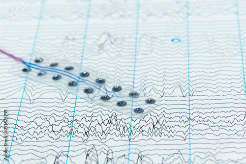 Fotografie Subdural electrode on background of brain waves