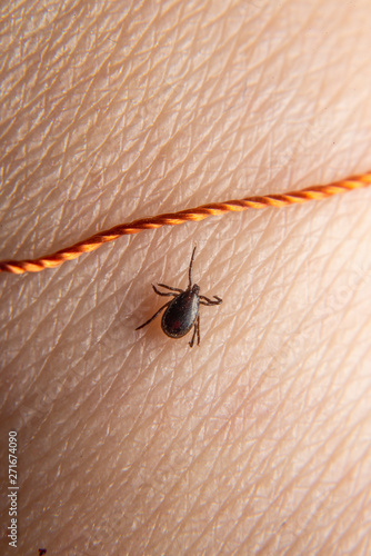 Hazardous mite, a Lyme Disease carrier bites a person. Extract the tick with a thread.