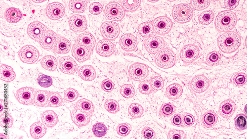 Photomicrograph of the human scalp, showing histology of hair follicles, cut as a tangential cross section.   photo