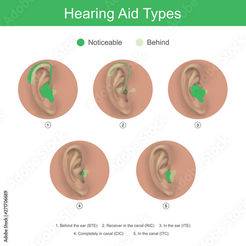 Hearing Aid Types