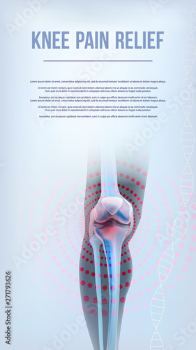 Bones the of knee pain relief