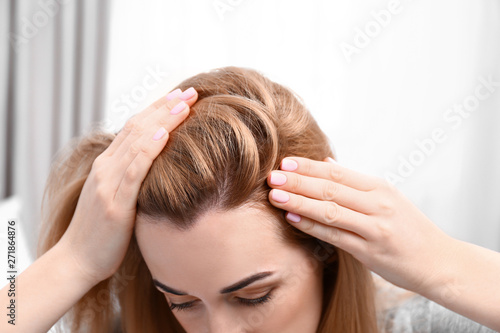 Young woman with hair loss problem on blurred background, closeup