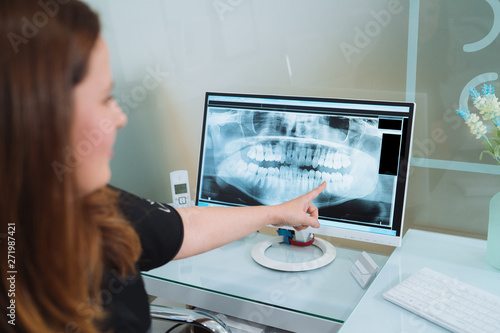 Female dentist showing x-ray footage of teeth to male patient in clinic