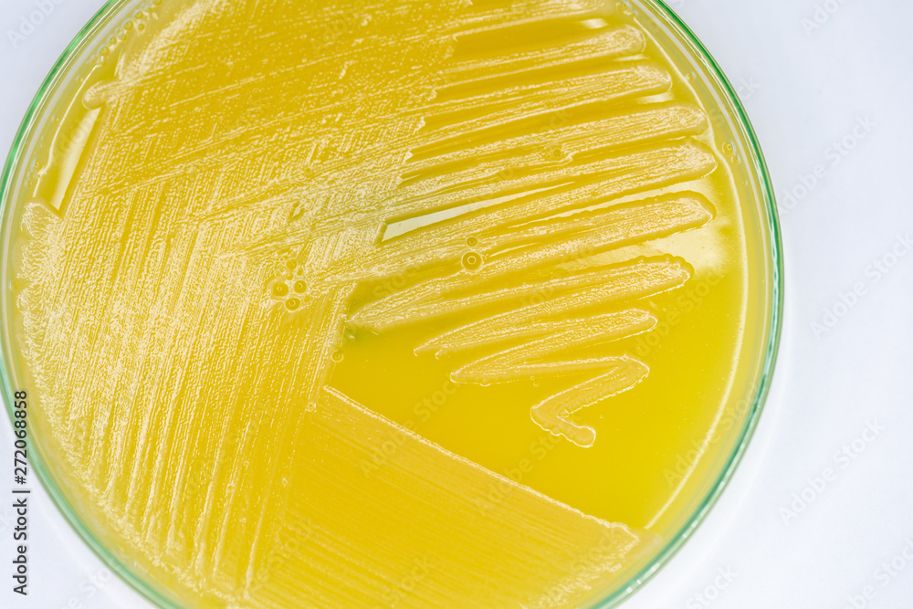 Study Colony characteristic of Actinomyces, Bacteria, yeast and Mold on