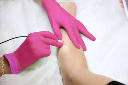 Female hands of the master and the client in the process of hair removal with an electric device for hair removal