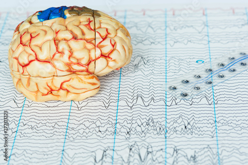 Human brain model and subdural electrode recording brain waves on background of brain waves photo