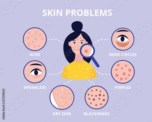 Medical poster showing problems of different types of skin flat vector illustration.