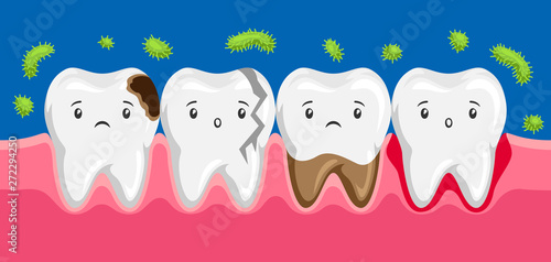 Illustration of sick teeth in oral cavity.