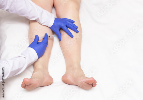 The doctor makes an injection of sclerotherapy to the patient who has varicose veins in the legs, miniphlebectomy, copy space