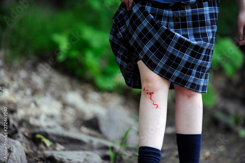 Fotografie blessure au genou
