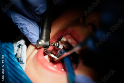 Dentist working on child teeth