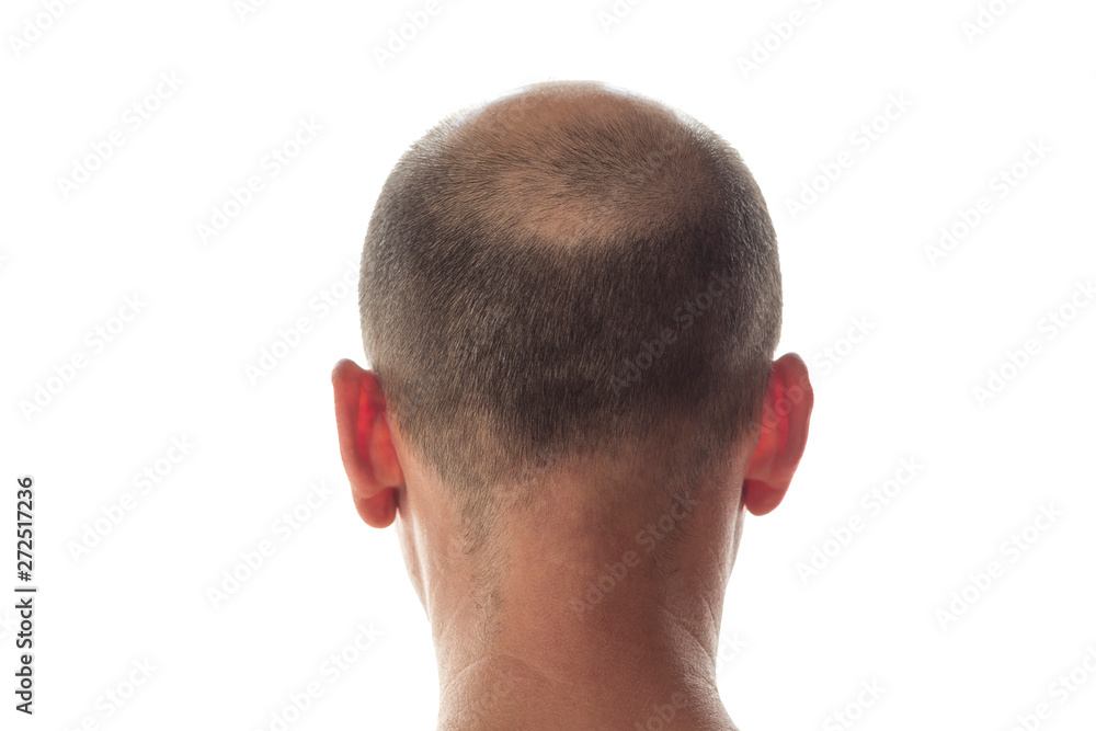 Obraz premium Bald man head on the back
