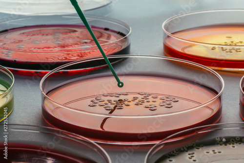 Close up of several Petri dishes