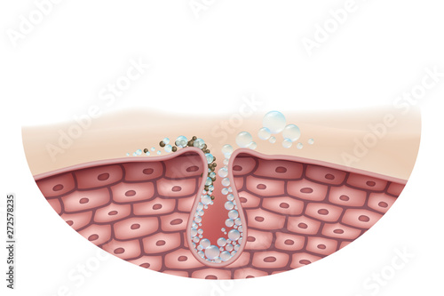 Deeply cleansing the skin, eliminating germs that clog pores cleanly. Use for cosmetics, soap, facial cleansing foam, acne treatment Vector Realistic file.