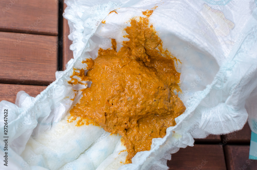 Child orange diarrhea excrement inside of stinky diaper. Close up