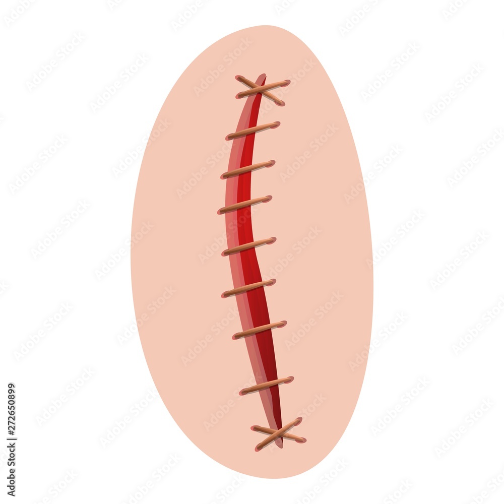Suture icon. Cartoon of suture vector icon for web design isolated on white background Suture icon. Cartoon of suture vector icon for web design isolated on white background