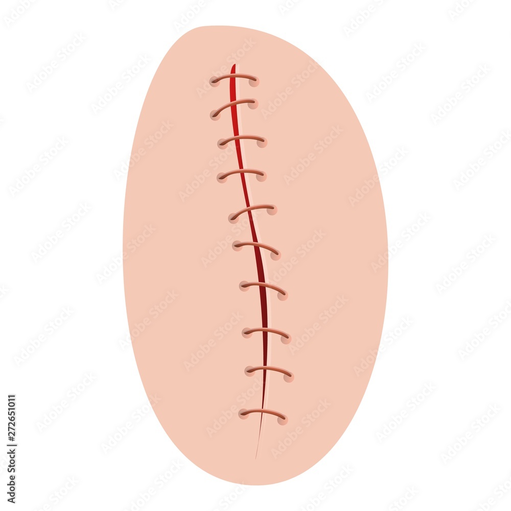 Surgical suture icon. Cartoon of surgical suture vector icon for web design isolated on white background Surgical suture icon. Cartoon of surgical suture vector icon for web design isolated on white background