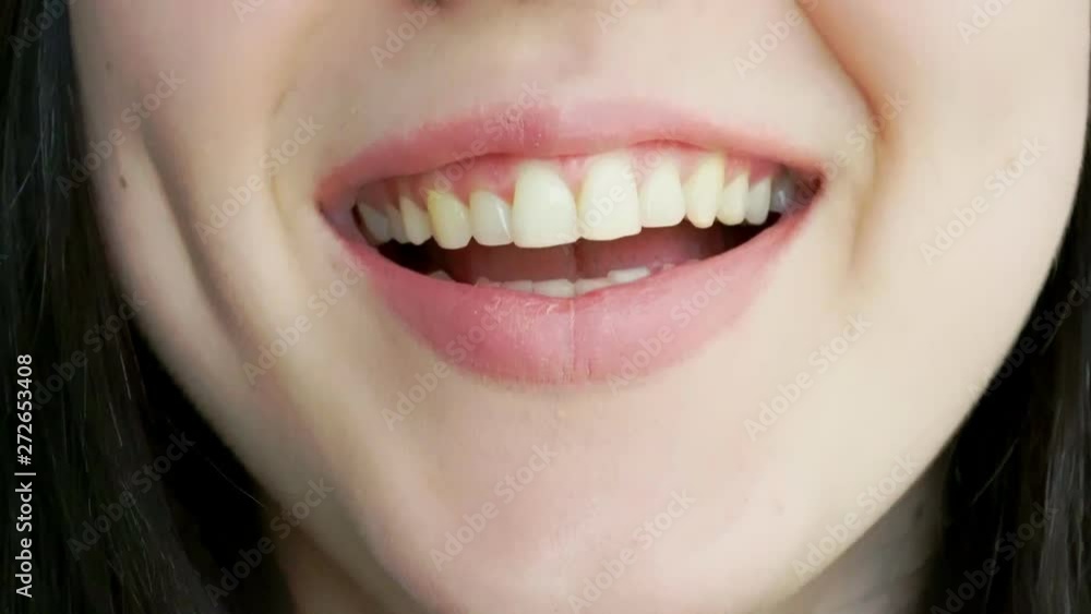 A young girl with big lips laughs and smiles. Close-up A young girl with big lips laughs and smiles. Close-up