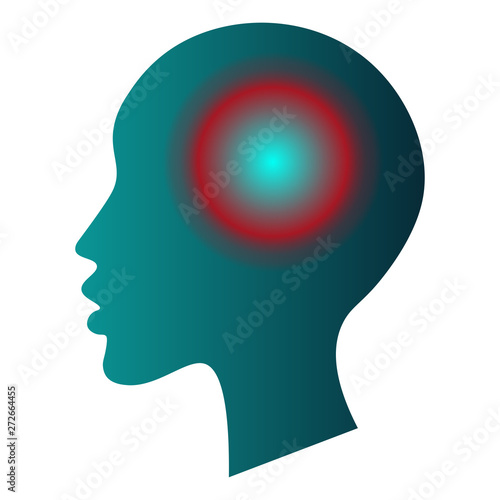 Medical infographic template - headache, migraine. Human head silhouette with pain localization sign mark. White background. For poster, presentation, brochure.