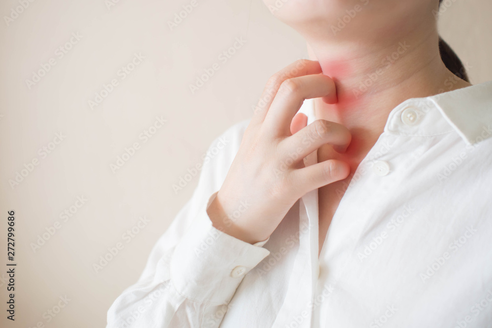 Young woman scratching the itch on her neck with redness rash. Cause of