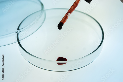 Pipettes take samples into the petri dishes have blood. photo