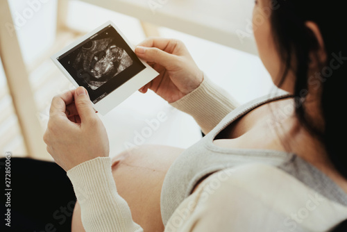 Hospital has ultrasound to help check the pregnancy for mother that the child is developing in the womb that is growing. And saw the image of the child moving in the womb Cause love Ties from unborn