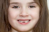 the close up portrait of little girl's face with missing front lower milk teeth in a smiling mouth