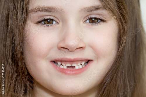 the close up portrait of little girl's face with missing front lower milk teeth in a smiling mouth © kapichka
