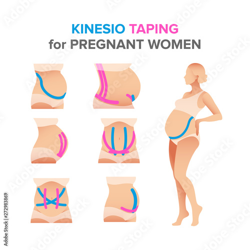 kinesio taping illustrations for pregnant women