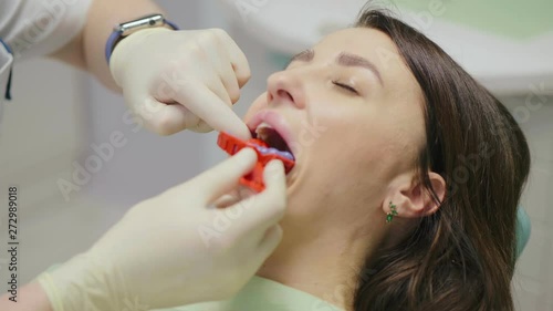 Close up of dentist using red plastic dental impression tray on woman teeth