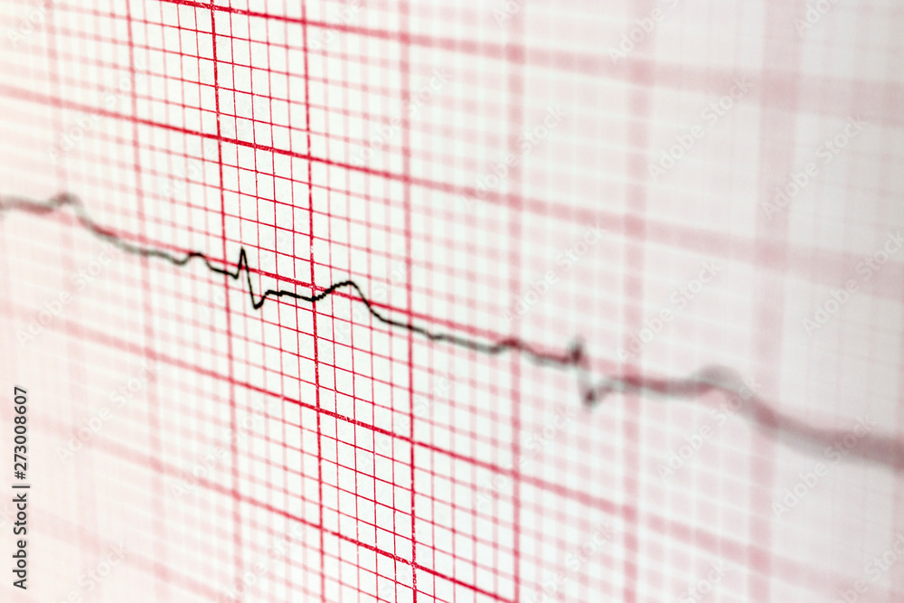 Cardiogram Cardiogram