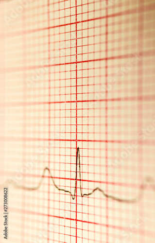 Cardiogram