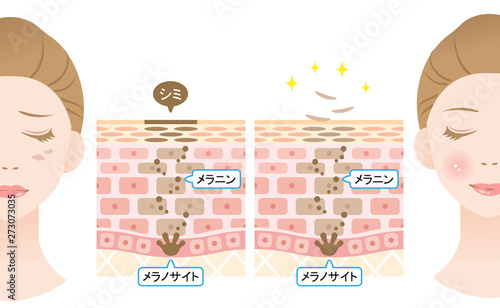 ターンオーバー　肌の断面図と女性