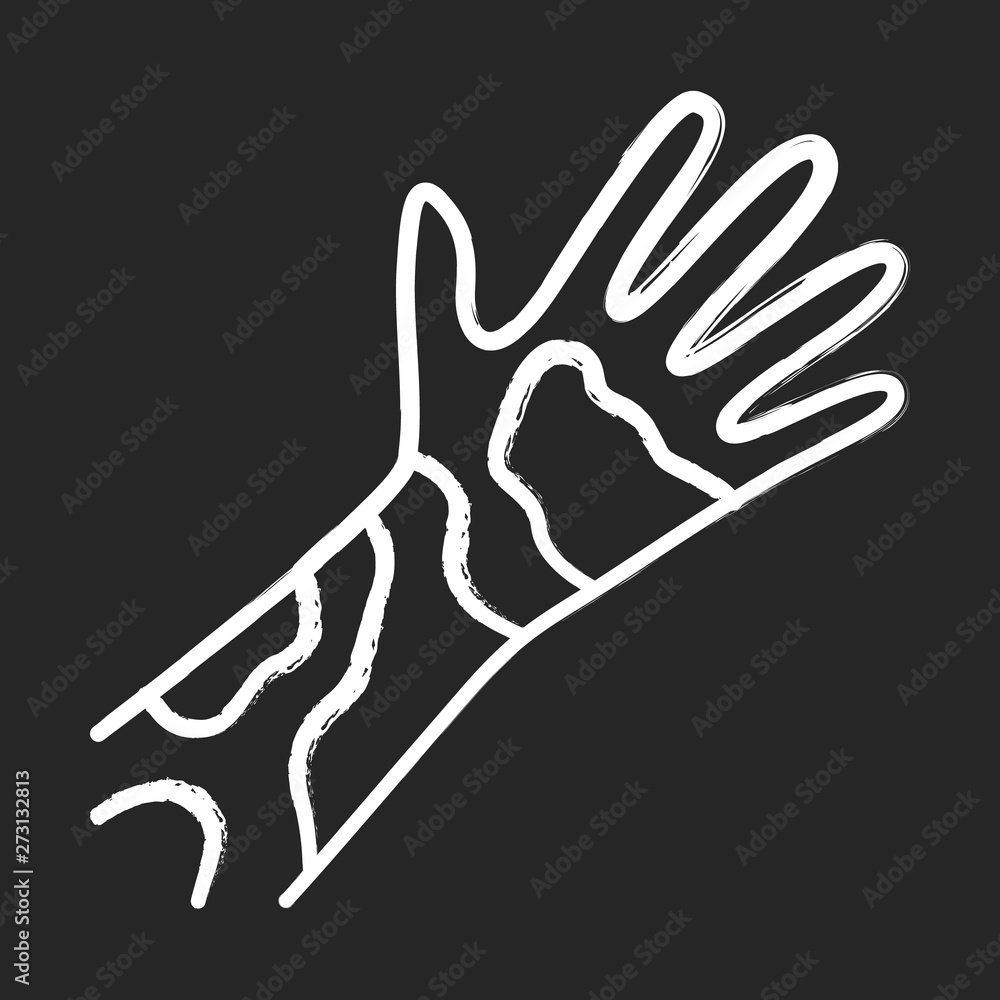 Contact dermatitis, hives chalk icon Contact dermatitis, hives chalk icon
