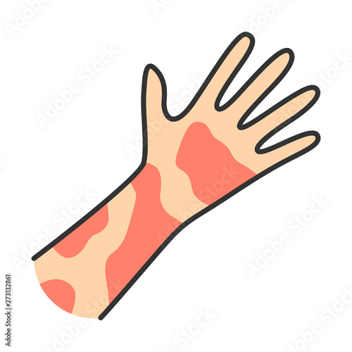 Contact dermatitis, hives color icon