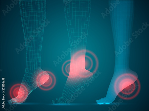 three-dimensional female feet. vector template. finished item. feet care