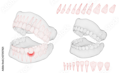 human jaw. 3d vector layout. medicine and health. pain teeth.