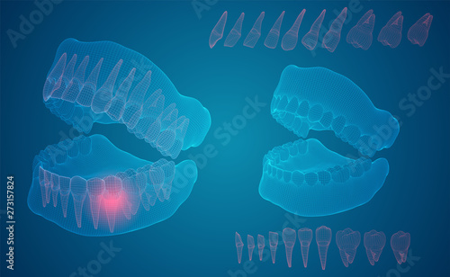 human jaw. 3d vector layout. medicine and health. pain teeth.