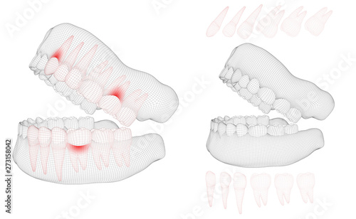 human jaw. 3d vector layout. medicine and health. pain teeth.