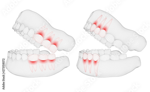 human jaw. 3d vector layout. medicine and health. pain teeth.