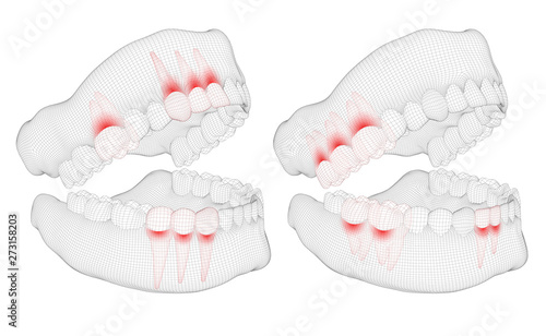 human jaw. 3d vector layout. medicine and health. pain teeth.