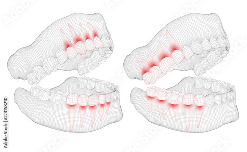 human jaw. 3d vector layout. medicine and health. pain teeth.
