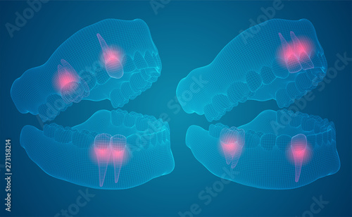 human jaw. 3d vector layout. medicine and health. pain teeth.